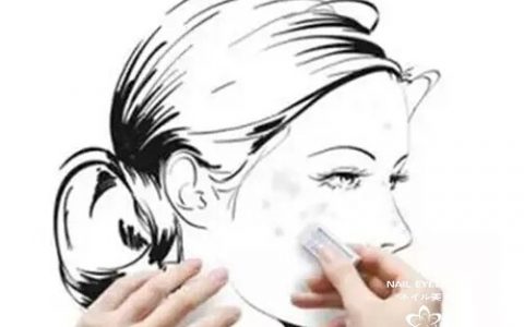 脸上长斑的日常注意事项，可以看看