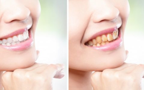 牙缝有个洞能补吗，，这样做简单不花钱
