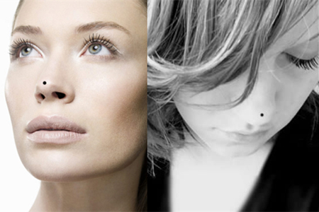 【图】鼻梁有痣好看吗，应该怎么祛除它