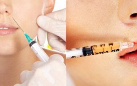 【图】水光针能保持多长时间，，美容效果如何