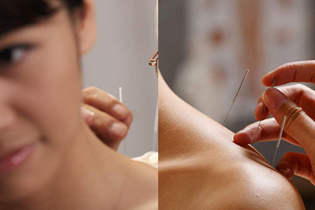针灸减肥反弹厉害吗，瘦身秘诀你要知道