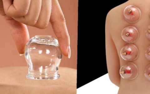 拔罐减肥反弹特别厉害吗，这样做避免再次肥胖