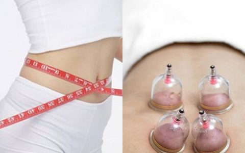 拔火罐减肥的原理详解，这些注意事项需牢记