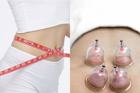 拔火罐减肥的原理详解，这些注意事项需牢记