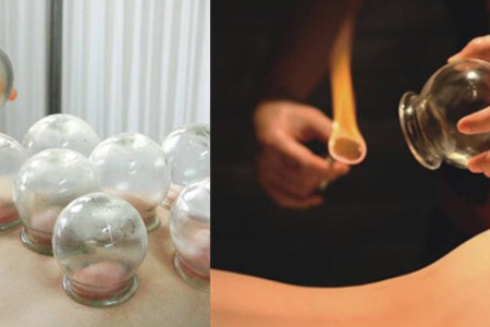 拔火罐减肥的原理详解，这些注意事项需牢记