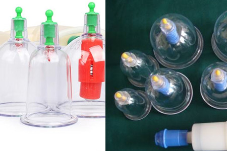 拔火罐减肥的原理详解，这些注意事项需牢记