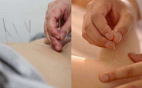 针灸减肥多久能瘦下来，了解这些很重要
