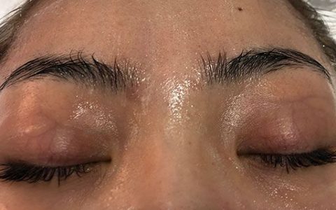 眼部皱纹能去掉么