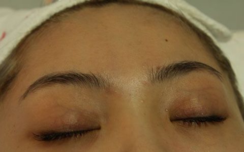 脸上有色斑怎么办