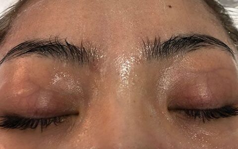 干皮变油皮怎么回事