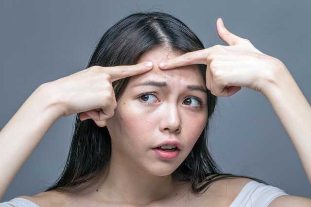 闭口怎么去除小妙招，告诉你简单的去除技巧