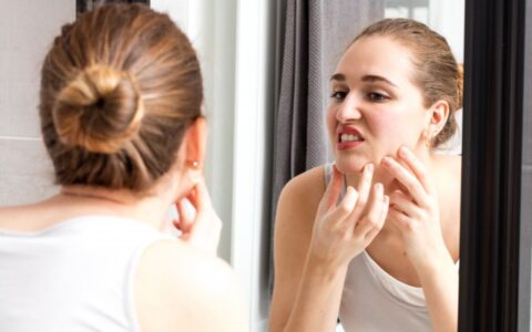 淡化黑色痘印有效的方法，恢复脸蛋光滑