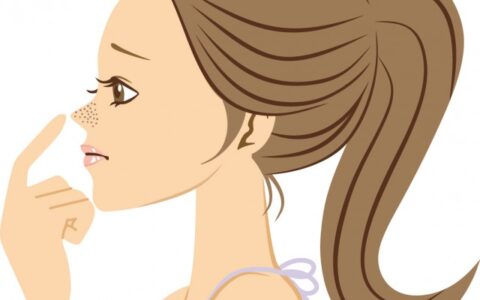 有黑头怎么去除，4个小技巧赶走草莓鼻