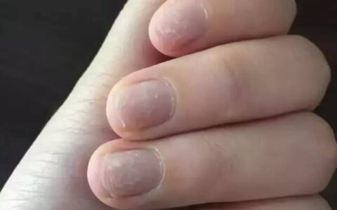 原来长时间不卸美甲，会有这么多危害