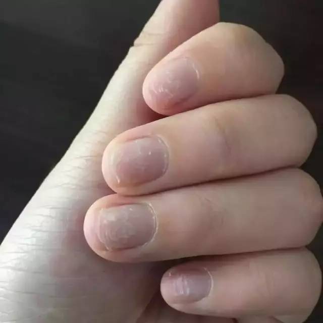 原来长时间不卸美甲，会有这么多危害！插图