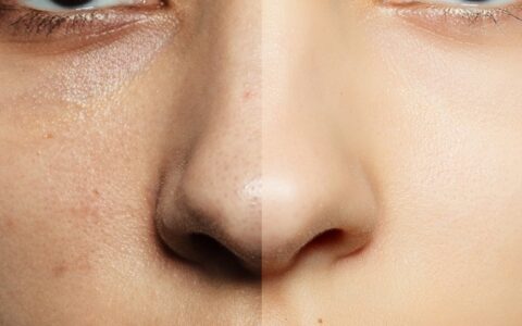 脸部怎么美白，脸部美白简单小妙招