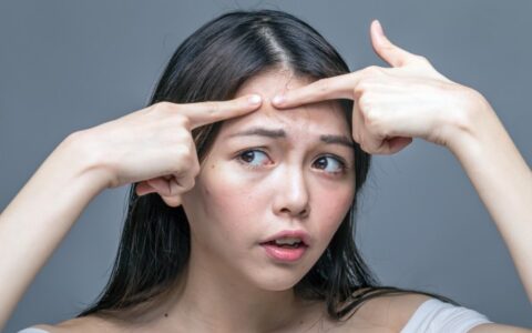 额头老长痘痘怎么办，额头长痘的原因及解决方法