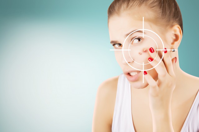 反复痘痘怎么调理，这样做让痘痘不再是烦恼