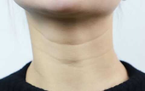 脖子下面的皱纹怎么去除 按摩让颈部肌肤更细嫩
