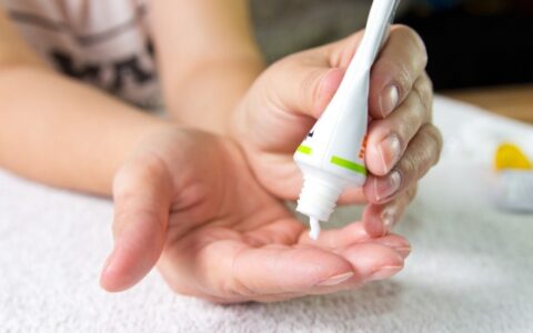 酒精伤皮肤后怎么护理 被酒精伤肤后的护理方法