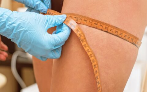 手术吸脂有危害吗，抽脂手术后要注意什么