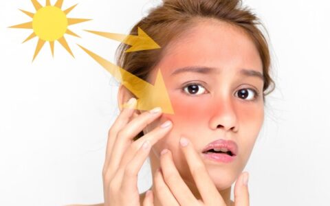 皮肤晒伤了怎么办，教你4招快速修复皮肤