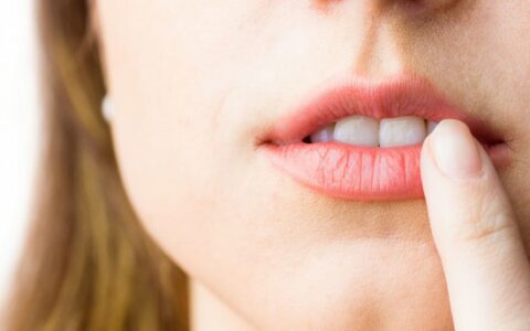 嘴唇干裂脱皮怎么办，6个办法解决嘴唇干裂