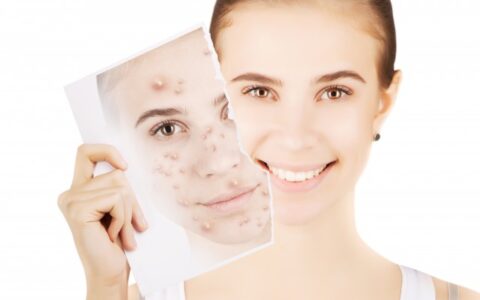 鼻子上长痘的原因，鼻头长痘主要有哪些原因