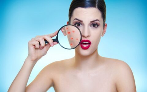 脸爆皮是怎么回事，怎么改善皮肤干燥爆皮