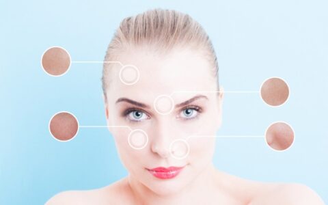 脸部毛孔大怎么办，脸部毛孔粗大怎么改善