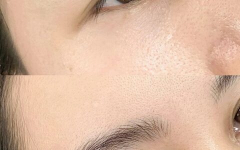 池州野生眉案例